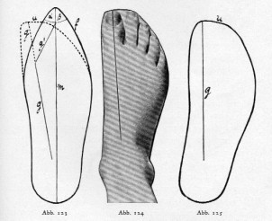 Tragen von falsch gestaltetem Schuhwerk